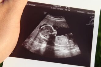 legatura dintre diabetul in timpul sarcinii si riscul de autism sau adhd al fatului 67f8fe72254cc