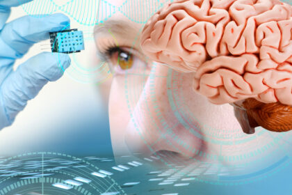 premiera medicala un implant cerebral revolutionar transforma gandurile in cuvinte in timp real 67fbc82e4a9d8