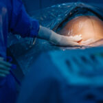 turcia interzice nasterile prin cezariana in clinici private regimul erdogan vorbeste despre nevoia de crestere a natalitatii 6807b8a034f66