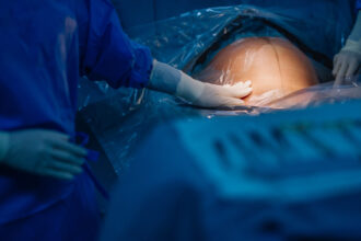 turcia interzice nasterile prin cezariana in clinici private regimul erdogan vorbeste despre nevoia de crestere a natalitatii 6807b8a034f66