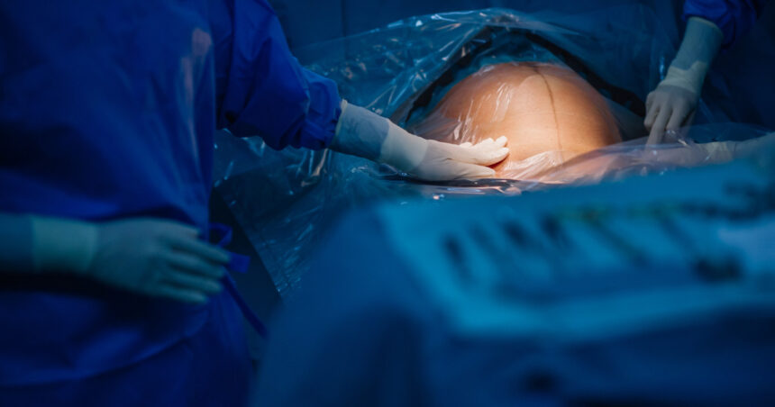 turcia interzice nasterile prin cezariana in clinici private regimul erdogan vorbeste despre nevoia de crestere a natalitatii 6807b8a034f66