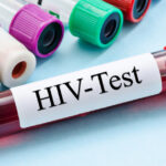 cercetatorii australieni uluiti de efectele unui nou tratament contra hiv descoperirea care ar putea duce la eradicarea virusului 68451e3f31bd6