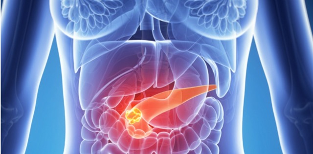 un nou test ar putea depista cancerul pancreatic in stadiile initiale 6851c4fb37279