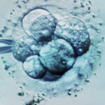 ceasul biologic al barbatilor legat de avorturile spontane in cazul fertilizarii in vitro 686c1120c5f5d