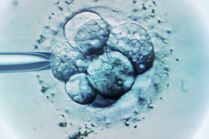 ceasul biologic al barbatilor legat de avorturile spontane in cazul fertilizarii in vitro 686c1120c5f5d