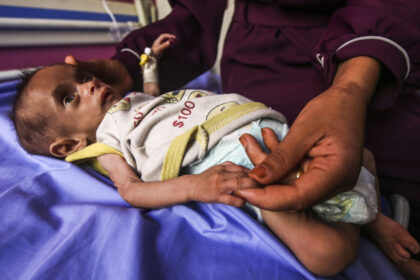 galerie foto infometare in masa numarul copiilor subnutriti din gaza cu varste sub 5 ani s a triplat in ultimele doua saptamani 6883ef0638a3a