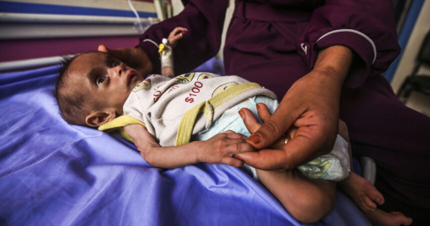 galerie foto infometare in masa numarul copiilor subnutriti din gaza cu varste sub 5 ani s a triplat in ultimele doua saptamani 6883ef0638a3a
