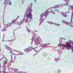 suspiciune de antrax la doua persoane internate la institutul national de boli infectioase matei bals din bucuresti 686e91c30a5a8