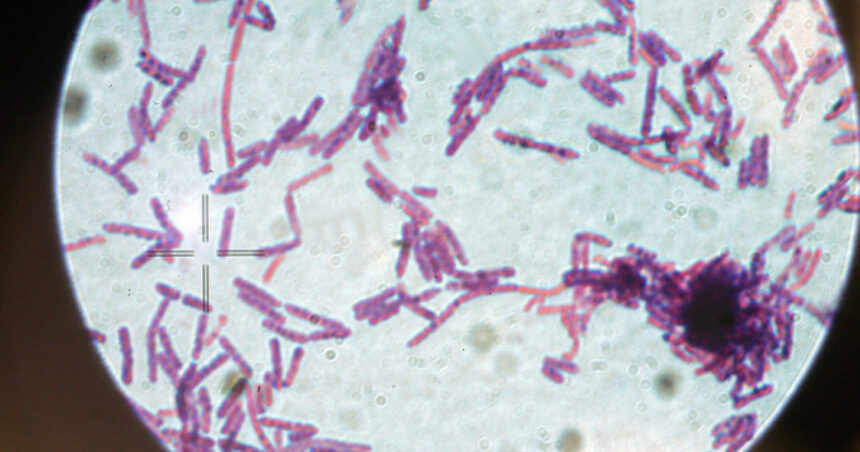 suspiciune de antrax la doua persoane internate la institutul national de boli infectioase matei bals din bucuresti 686e91c30a5a8