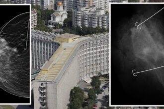 premiera medicala in patologia mamara la spitalul clinic judetean de urgenta constanta 689367db0bfc9