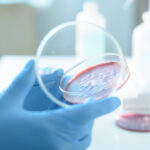 ce este serratia marcescens bacteria descoperita la spitalul sfanta maria din iasi unde au murit sase copii 68d692fb7fc73