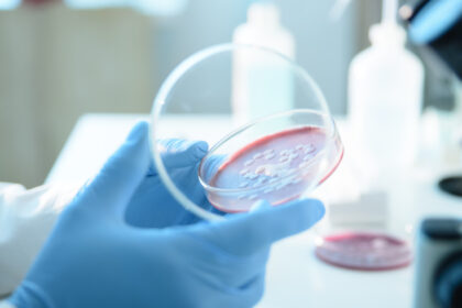 ce este serratia marcescens bacteria descoperita la spitalul sfanta maria din iasi unde au murit sase copii 68d692fb7fc73