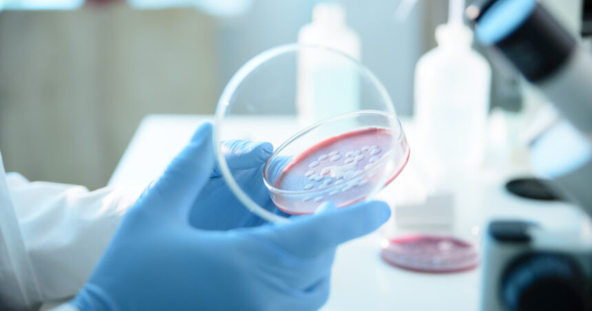 ce este serratia marcescens bacteria descoperita la spitalul sfanta maria din iasi unde au murit sase copii 68d692fb7fc73