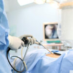 chirurgia laparoscopica medicina moderna care aduce vindecare cu trauma minima 68d68a2ea55aa