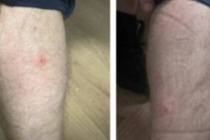 foto politisti muscati de plosnite in sediile politiei capitalei zece persoane au ajuns la urgenta ce masuri cere sindicatul europol 68b880057809e