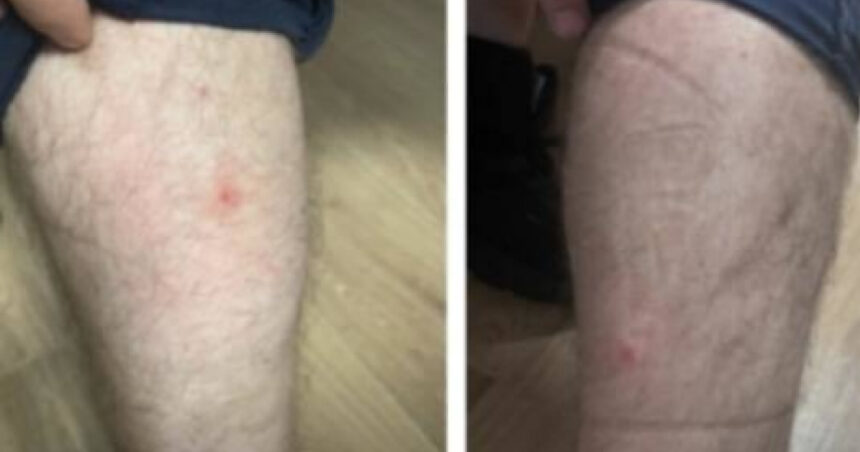 foto politisti muscati de plosnite in sediile politiei capitalei zece persoane au ajuns la urgenta ce masuri cere sindicatul europol 68b880057809e