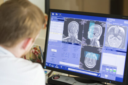 povestea gemenilor diagnosticati cu aceeasi boala extrem de rara la 8 ani distanta nici medicii nu inteleg cum a fost posibil 68c5004a46ee7