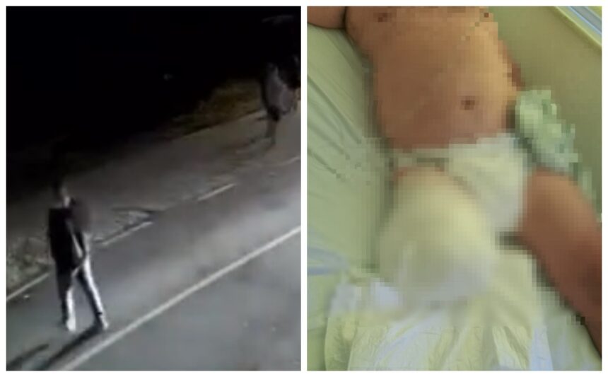 video imagini cu puternic impact emotional din timpul producerii accidentului de la oltina unde un barbat a ramas fara un picior 68c7c3f408c31
