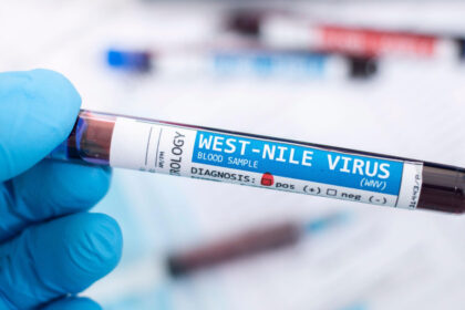 video restrictii la donarea de sange in judetele cu cazuri confirmate de west nile ce trebuie sa stie donatorii 68bbf90cb687c