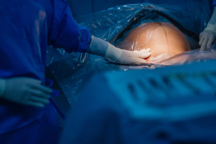 reactia spitalului privat din constanta unde o tanara a murit dupa ce a nascut la raportul ministerului sanatatii 68f8e80e2572f