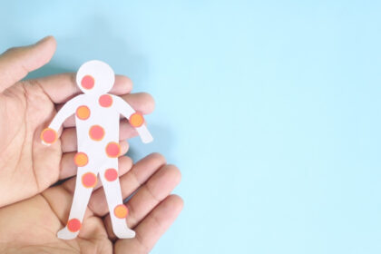 canada isi pierde statutul de tara fara rujeola sua sunt si ele aproape in aceeasi situatie 691256ff72853