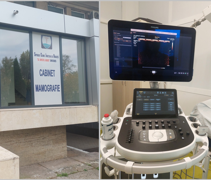 foto spitalul judetean constanta a achizitionat un ecograf unic in romania pentru depistarea precoce a cancerului de san 691782a59c139