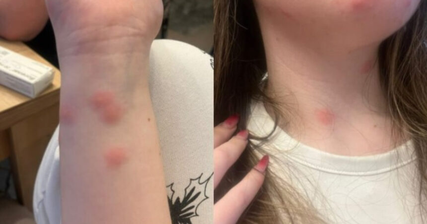 video o tanara a ajuns la spital dupa ce a fost muscata de plosnite intr un tren cfr familia a facut plangere 6922d1f3509ef