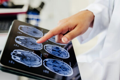 video premiera medicala la spitalul bagdasar arseni din bucuresti operatie pe creier cu pacientul treaz a fost foarte curajos 691c21a65de2b