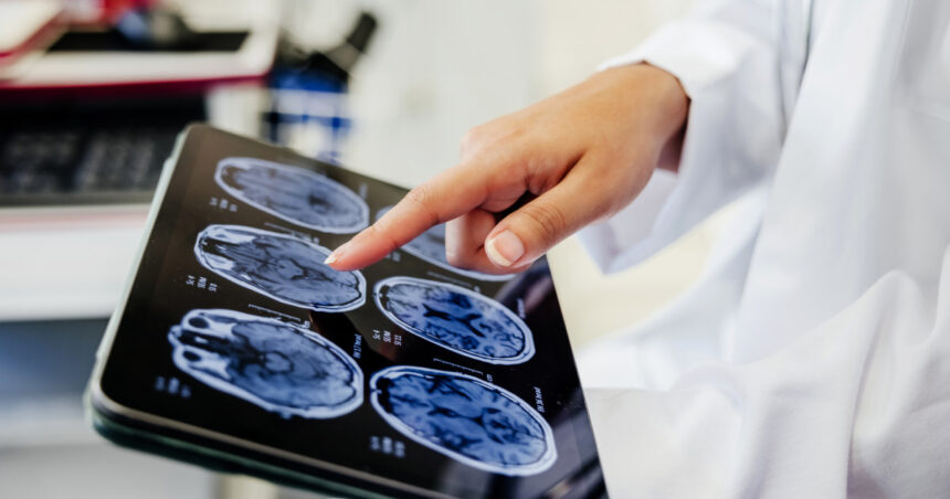 video premiera medicala la spitalul bagdasar arseni din bucuresti operatie pe creier cu pacientul treaz a fost foarte curajos 691c21a65de2b