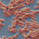 caz de lepra in romania de cate feluri este boala cum se manifesta si cum se trateaza explicatiile unui medic 693bf354d7e3f