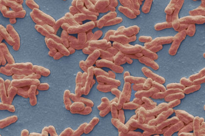 caz de lepra in romania de cate feluri este boala cum se manifesta si cum se trateaza explicatiile unui medic 693bf354d7e3f