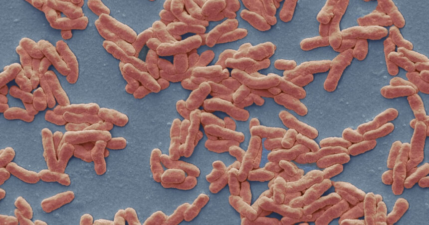 caz de lepra in romania de cate feluri este boala cum se manifesta si cum se trateaza explicatiile unui medic 693bf354d7e3f