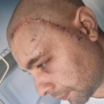 mihai un tanar din mangalia are nevoie urgenta de ajutor pentru a lupta cu boala nemiloasa care ii macina sanatatea 692e94ff56b89