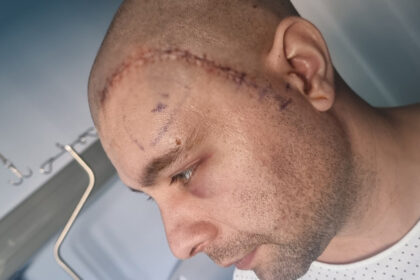 mihai un tanar din mangalia are nevoie urgenta de ajutor pentru a lupta cu boala nemiloasa care ii macina sanatatea 692e94ff56b89