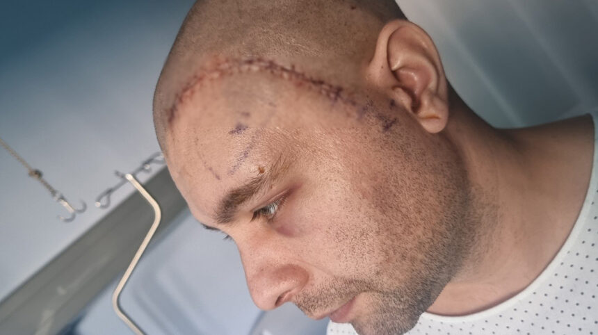 mihai un tanar din mangalia are nevoie urgenta de ajutor pentru a lupta cu boala nemiloasa care ii macina sanatatea 692e94ff56b89