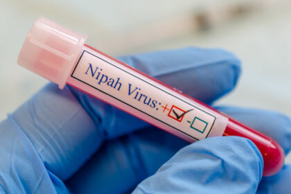 ce este virusul nipah care a declansat controale de securitate pe aeroporturile din asia ce riscuri exista pentru romania 6979f7e40a8aa