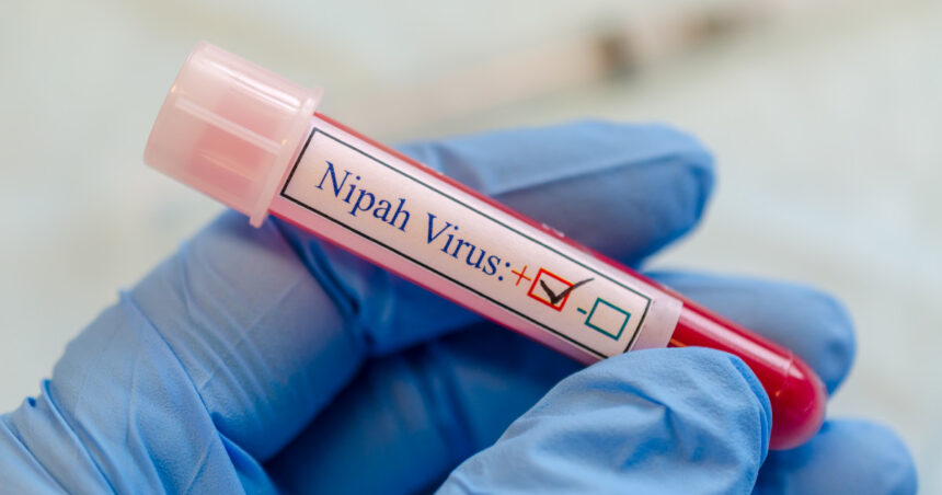 ce este virusul nipah care a declansat controale de securitate pe aeroporturile din asia ce riscuri exista pentru romania 6979f7e40a8aa