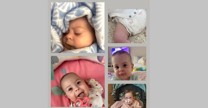 apel umanitar pentru elisa micuta de doi anisori cu cate 5 programari pe zi la medic pentru a supravietui si a merge mai departe cum puteti ajuta 69a29fec87984