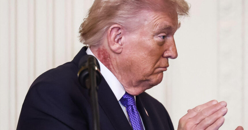 noi intrebari despre starea de sanatate a lui donald trump ce este pata rosie aparuta pe gatul presedintelui american 69a6098932a1e