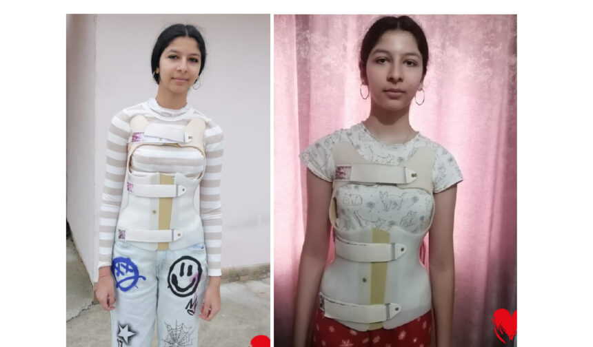 o afectiune crunta ii curbeaza coloana erikai in fiecare zi operatia este sansa mea va rog din suflet ajutati ma 69c10b430d834