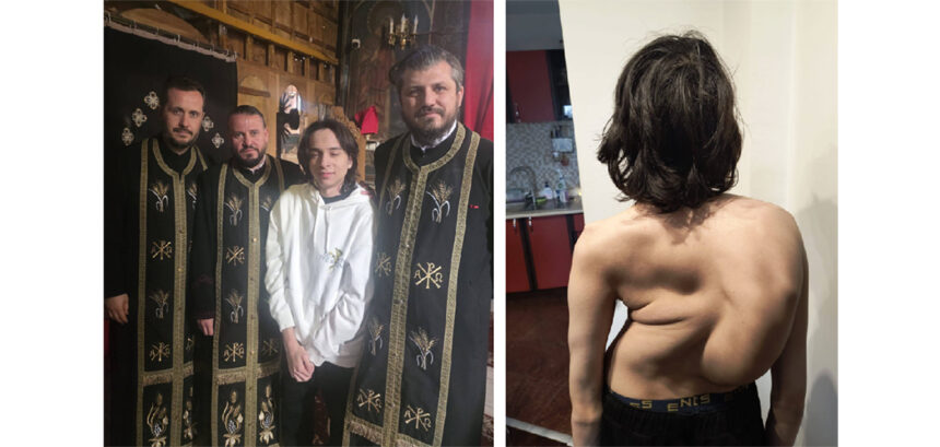 apel al preotilor parohiei topraisar ajutor pentru matei un adolescent din mangalia ce trebuie operat urgent pe coloana 69eb29be24a7d