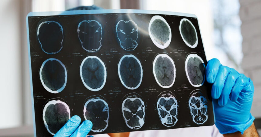 asociatiile de pacienti cer interventia ministerului sanatatii si cnas dupa scaderea cu 47 a investigatiilor de monitorizare 69cf944dd316a