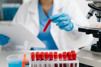premiera o tehnica noua a fost utilizata cu succes pentru tratarea unei afectiuni sangvine de care sufera multi oameni 69ddc0833ce84