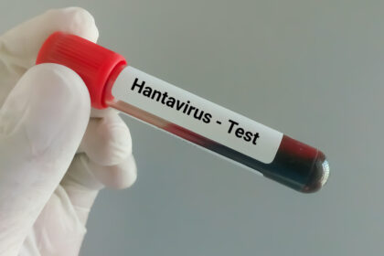 ce este hantavirusul infectia care a provocat trei decese pe o nava de croaziera medicii explica ce riscuri exista in romania 69f9d27772f2e