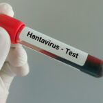 suspiciune de infectie cu hantavirus in cazul unui pompier de la isu caras severin barbatul ar fi calatorit in serbia 6a0f4ccbb4664
