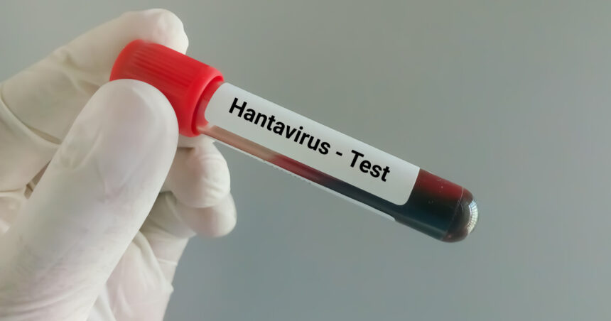 video suspiciune de hantavirus la arad autoritatile au declansat o ancheta epidemiologica ce spun medicii despre tulpina virusului 6a07523de4533