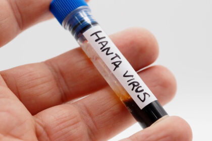 ancheta epidemiologica in argentina noua varianta de hantavirus identificata la rozatoare fara legatura cu focarul de pe mv hondius 6a42b3ca47ab0