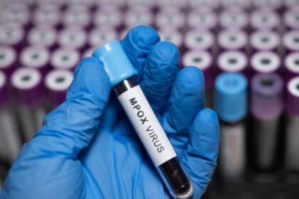 doi oameni de stiinta acuzati ca au adus ilegal in sua fiole cu virus mpox dezactivat din africa si au mintit autoritatile 6a21514c7de81