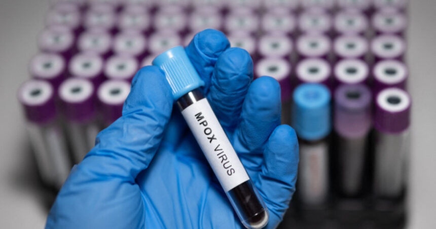 doi oameni de stiinta acuzati ca au adus ilegal in sua fiole cu virus mpox dezactivat din africa si au mintit autoritatile 6a21514c7de81