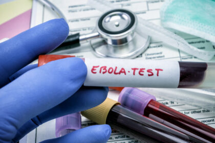 virusul ebola poate ramane ascuns in organism luni sau ani cum poate reaparea infectia studiu 6a3673efe2995